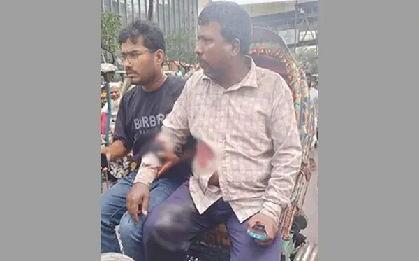 মতিঝিলে ব্যবসায়ীকে গুলি করে ১৭ হাজার ডলার ছিনতাই