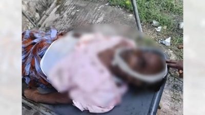 কুষ্টিয়া হাসপাতালে দুর্ঘটনার শিকার রোগীর বিচ্ছিন্ন পা খুঁজে পাওয়া যায়নি