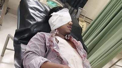 সিরাজগঞ্জে চলন্ত ট্রেনে পাথর নিক্ষেপ, যাত্রীর চোখে গুরুতর জখম