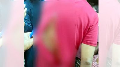 মোহাম্মদপুরে ইমিগ্রেশন পুলিশের এসআইকে কুপিয়ে জখম, পিঠে ৪৩ সেলাই