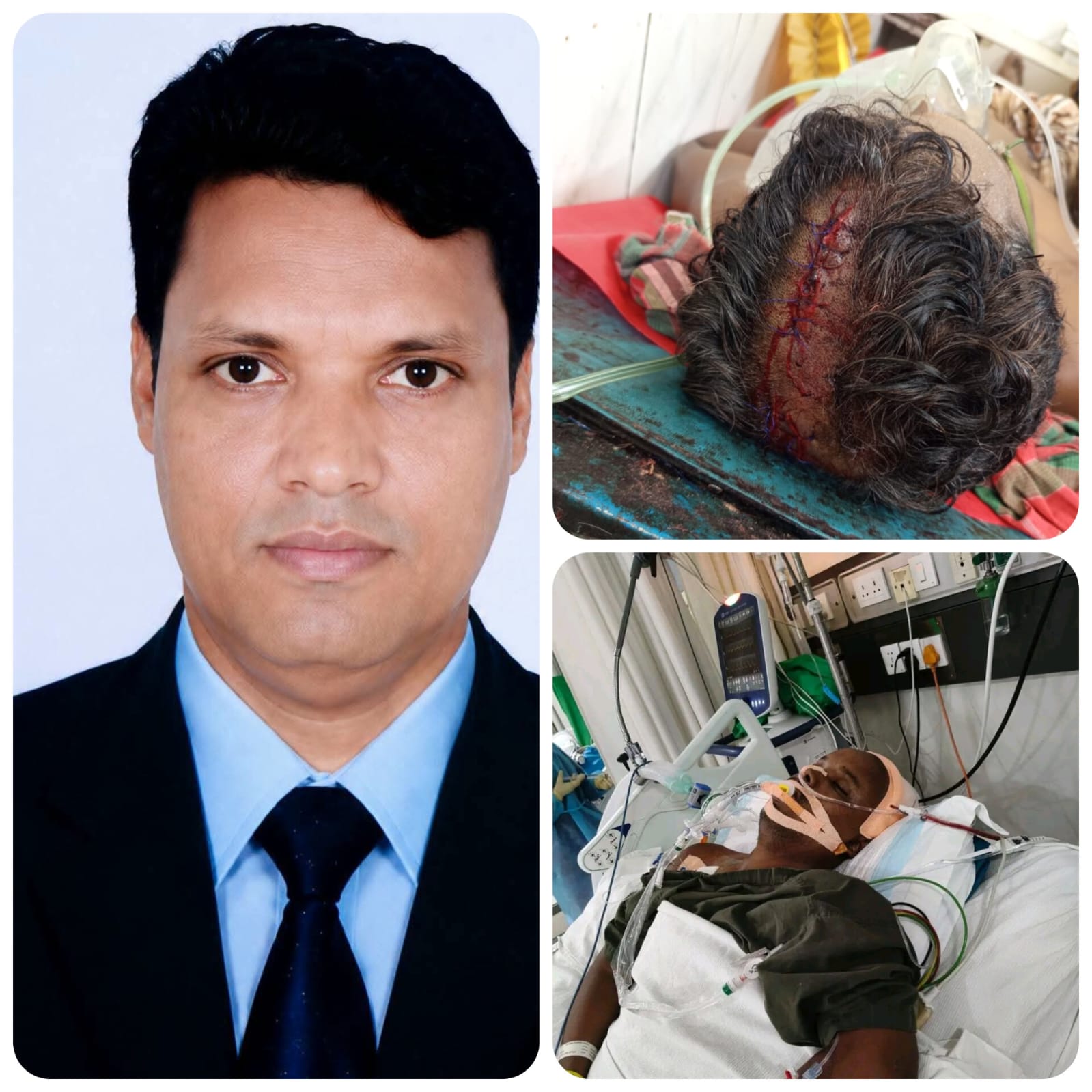 অনলাইন জুয়ার প্রতিবাদ করায় কলেজ শিক্ষককে কুপিয়ে জখম, ৮ দিনেও জ্ঞান ফেরেনি