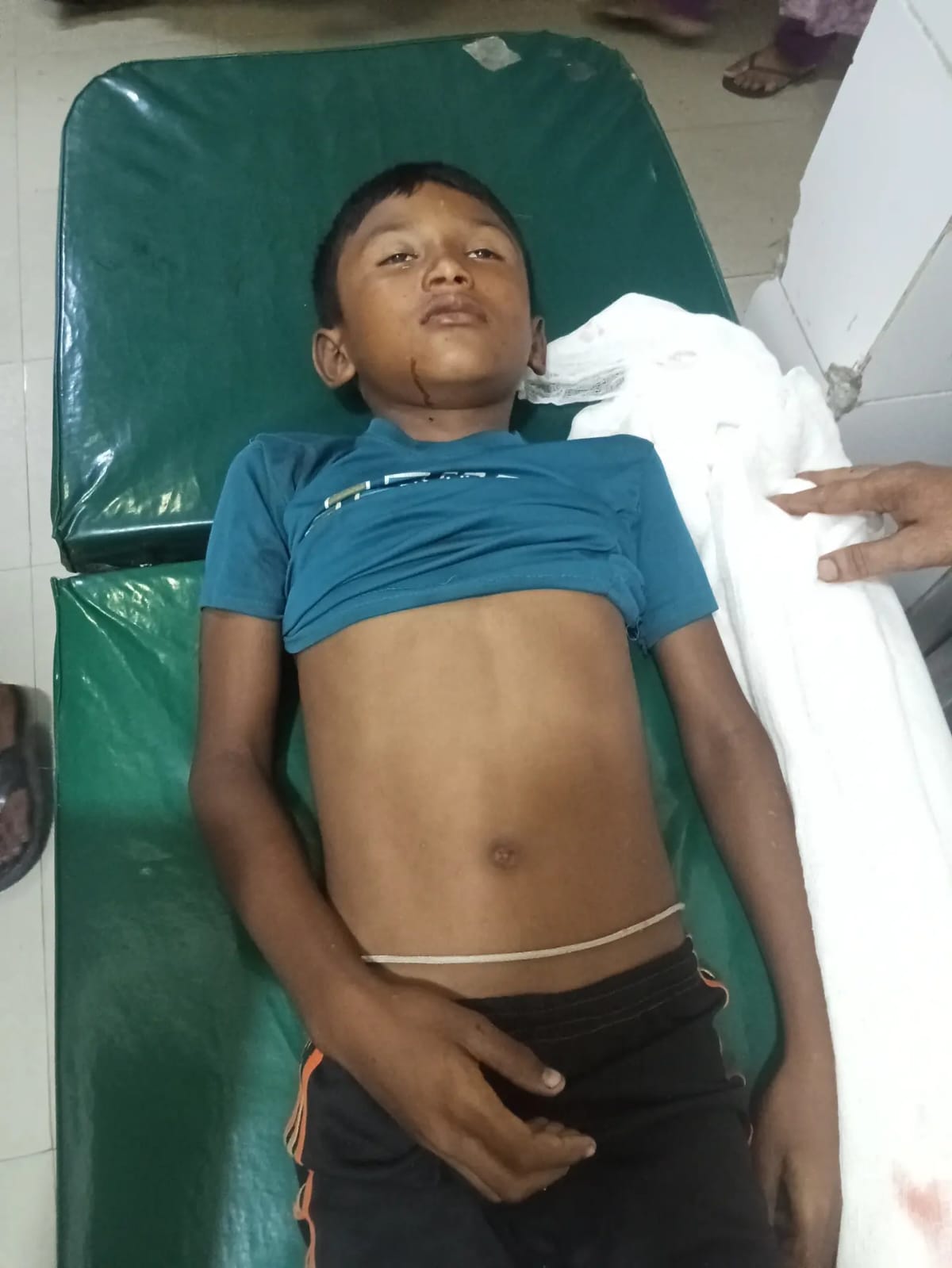 সুনামগঞ্জের গৌরারংয়ে অটোরিকশার ধাক্কায় এক স্কুল শিক্ষার্থীর মৃত্যু