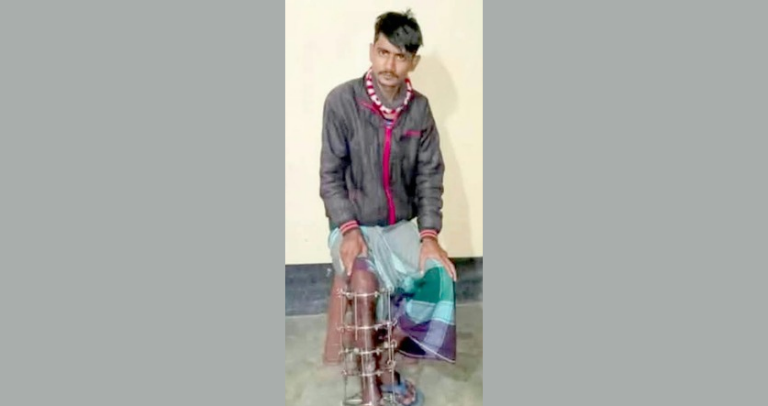সুনামগঞ্জে সড়ক র্দূঘটনায় গুরুতর আহত মোটর সাইকেল চালক সুবিনয়ের অপারেশনের জন্য দু”লাখ টাকা আর্থিক সহায়তার আবেদন